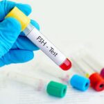 أسباب ارتفاع هرمون fsh