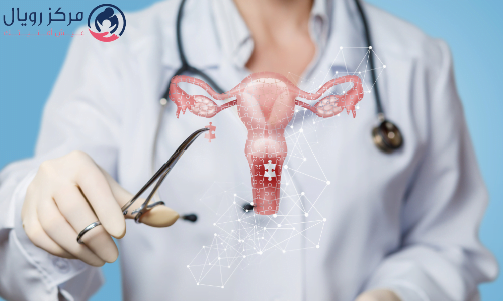 اسباب الورم الليفى بالرحم