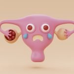 شكل افرازات الإجهاض