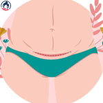 الى متى يستمر ألم العملية القيصرية