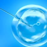 التحاليل المطلوبة للحقن المجهرى