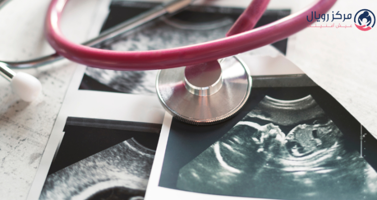 تجارب الحمل بعد الحقن المجهري